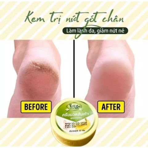 Kem Nứt Gót Chân Chiết Xuất Chuối & Bơ Hạt Mỡ - Dưỡng Da Mềm Mại & Chống Nứt Gót Chân Thái Lan