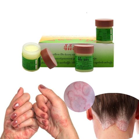 Kem 29A Thái Lan - Chữa Chàm, Ghẻ Ngứa, Hắc Lào, Lang Ben - Tinh Dầu Psoriasi Eczma Cho Da Thoải Mái