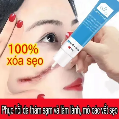Kem Xóa Sẹo 20g Dermatix Ultra - Gel Mờ Hiệu Quả Vết Sẹo Lâu Năm, Phẫu Thuật, Bảo Vệ Da Uv, Dưỡng Ẩm Silicon Polymer