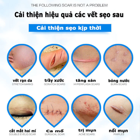 Kem Xóa Sẹo 20g Dermatix Ultra - Gel Mờ Hiệu Quả Vết Sẹo Lâu Năm, Phẫu Thuật, Bảo Vệ Da Uv, Dưỡng Ẩm Silicon Polymer