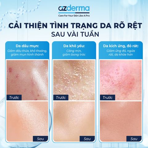 Kem Dưỡng Ẩm Phục Hồi Hàng Rào Bảo Vệ Azderma 40ml - Kem Dưỡng Ẩm Chuyên Sâu, Cấp Nước, Giúp Da Sáng Khỏe Mịn Màng