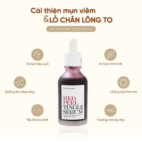 Tinh Chất Peel Tái Tạo Da So Natural Red Peel Tingle Serum 35ml - Hỗ Trợ Làm Sáng Da, Giảm Mụn Đầu Đen, Mờ Thâm