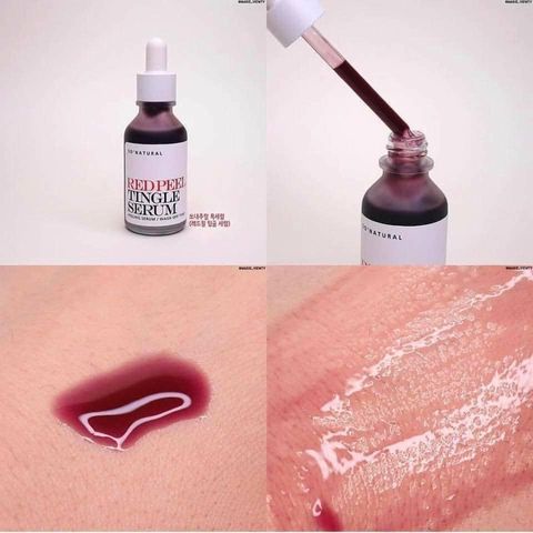 Tinh Chất Peel Tái Tạo Da So Natural Red Peel Tingle Serum 35ml - Hỗ Trợ Làm Sáng Da, Giảm Mụn Đầu Đen, Mờ Thâm