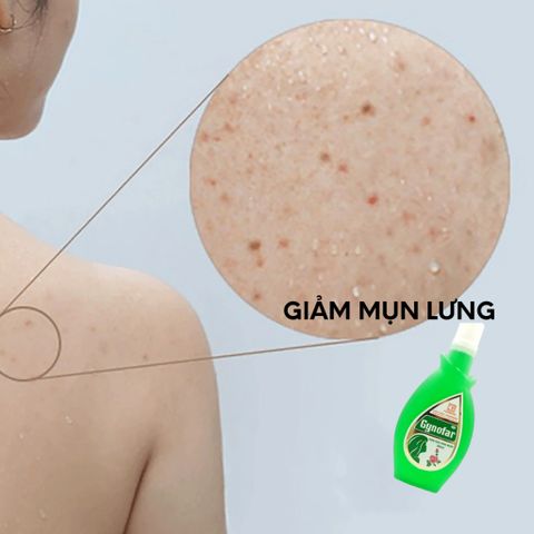 Dung Dịch Vệ Sinh Phụ Nữ Gynofar 250ml - 500ml, Cân Bằng pH, Giảm Kích Ứng, Chiết Xuất Tự Nhiên, An Toàn Cho Phụ Nữ Mọi Lứa Tuổi