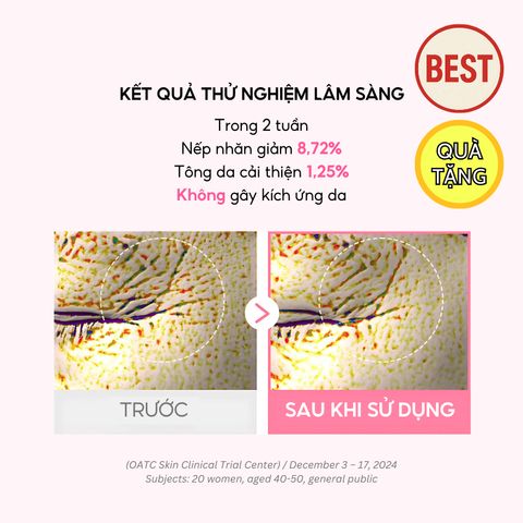Mặt Nạ Thạch Collagen iMU Deep Jelly Pack 34g - Dưỡng Ẩm, Chống Lão Hóa, Làm Sáng Da, Xuất xứ Hàn Quốc - Hộp 4 Miếng