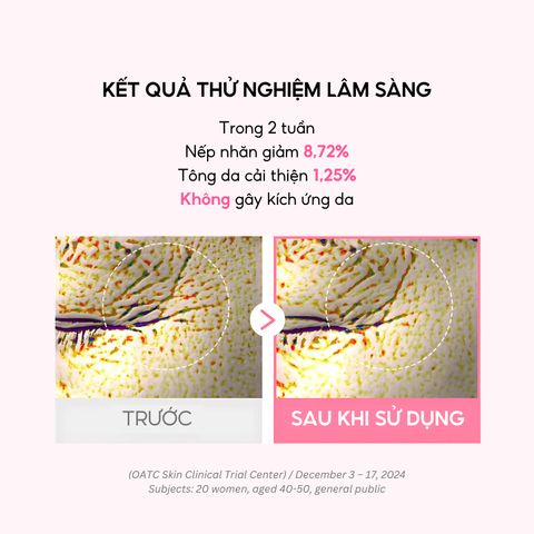 Combo 2 Hộp Mặt Nạ Thạch Collagen Hàn Quốc IMU Deep Collagen Jelly Pack - Dưỡng Ẩm, Chống Lão Hóa, Làm Sáng Da - 8 Miếng 34g