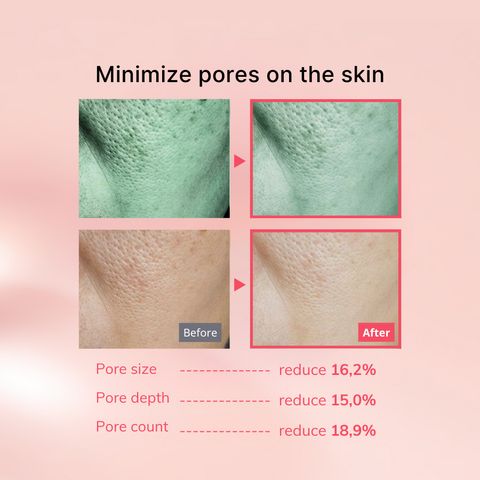 Combo Mặt Nạ Thạch Collagen IMU 4 Miếng + Tinh Chất Ampoule 50ml - Dưỡng Ẩm Chống Lão Hóa, Làm Sáng Da Hàn Quốc