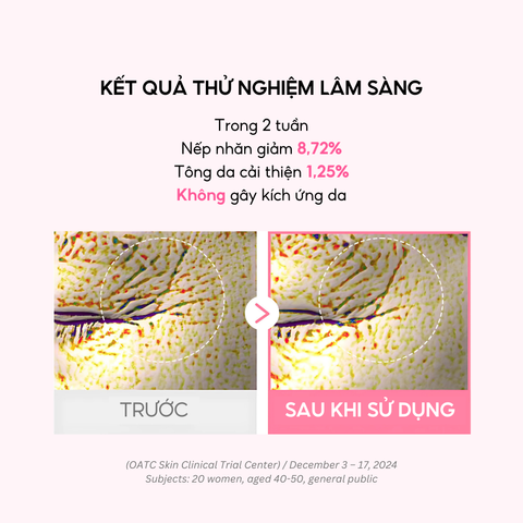 Mặt Nạ Thạch Collagen iMU Deep Jelly Pack 34g - Dưỡng Ẩm, Trắng Da, Phục Hồi, Chậm Lão Hóa - Hộp 4 Miếng Xuất Xứ Hàn Quốc