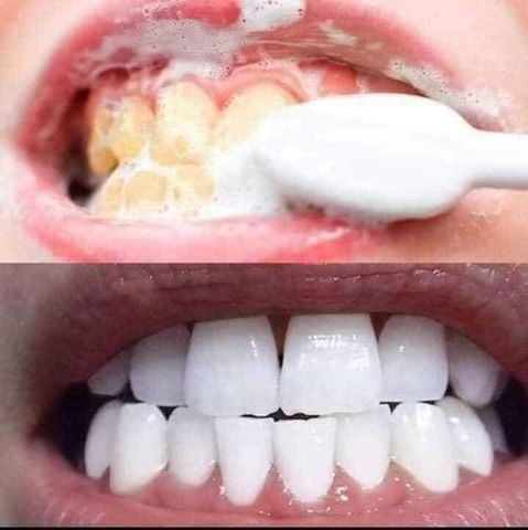 Kem Đánh Răng Trắng Sáng AP24 110gr - Nuskin Mỹ, Giải Pháp Làm Trắng Răng, Không Mài Mòn, Chống Hôi Miệng, Bảo Vệ Men Răng