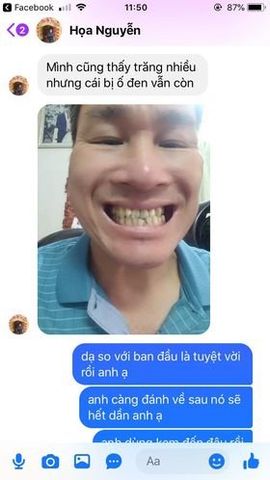 Kem Đánh Răng Trắng Sáng AP24 110gr - Nuskin Mỹ, Giải Pháp Làm Trắng Răng, Không Mài Mòn, Chống Hôi Miệng, Bảo Vệ Men Răng