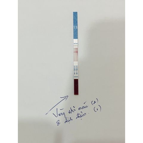 Bộ Test xét nghiệm Vi Khuẩn HP dạ dầy (H. Pylori) Chính hãng Fastep Mỹ
