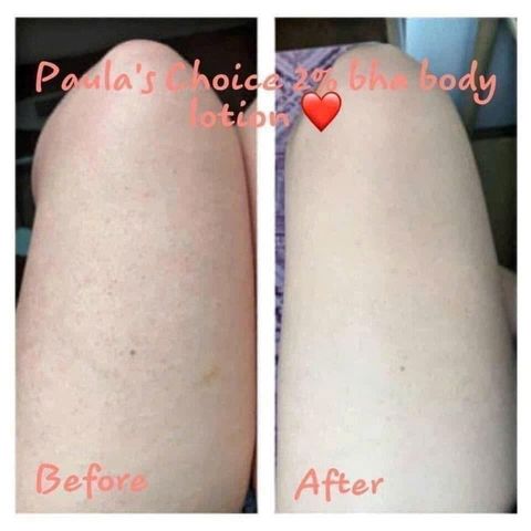 Kem Dưỡng Thể Paula's Choice BHA 2% - Chăm Sóc Da Mềm Mại & Sáng Màu 210ml, Giải Pháp Cho Làn Da Khỏe Mạnh