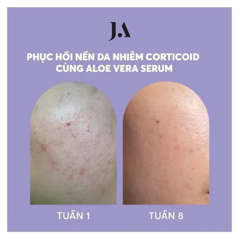 Tinh Chất Lô Hội Juliette Armand - Serum Làm Dịu, Cấp Ẩm Cho Da Nhạy Cảm 20ml-50ml - Dưỡng Ẩm Tự Nhiên, An Toàn, Hàng Chính Hãng
