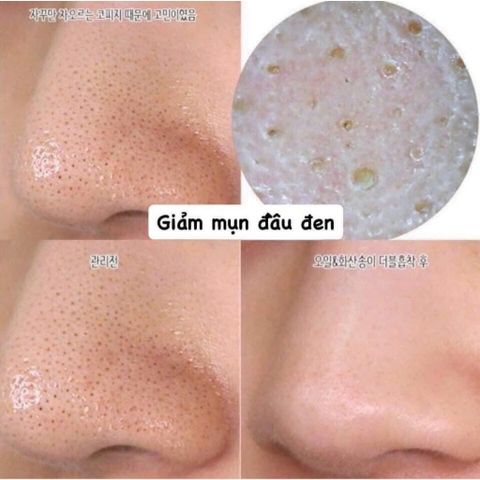 Mặt Nạ Innisfree Super Volcanic Pore Clay Mask 100ml - Se Khít Lỗ Chân Lông, Kiểm Soát Dầu, Sản Phẩm Chăm Sóc Da Hàn Quốc 2023