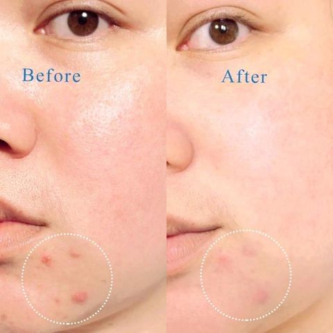 Set 3 Món Sữa Rửa Mặt La Roche-Posay Effaclar Gel - Dành Cho Da Dầu Mụn, Làm Sạch Nhẹ Nhàng, Giảm Mụn, Làm Dịu Da Nhạy Cảm