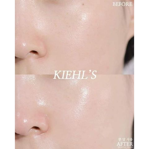 Serum Kiehl's Sáng Da Mờ Thâm Vitamin C - Giải Pháp Rạng Rỡ, Làm Mượt Da, Khắc Phục Vết Thâm Mụn 30ml