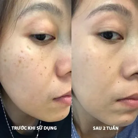 Tinh Chất Giảm Thâm Nám Dạng Bút Chấm EUCERIN UltraWHITE+ SPOTLESS SPOT CORRECTOR 5ml - Giúp Làm Sáng Da, Giảm Đốm Nâu, Dễ Dàng Sử Dụng
