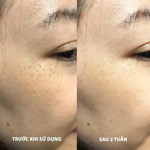 Tinh Chất Giảm Thâm Nám Dạng Bút Chấm EUCERIN UltraWHITE+ SPOTLESS SPOT CORRECTOR 5ml - Giúp Làm Sáng Da, Giảm Đốm Nâu, Dễ Dàng Sử Dụng