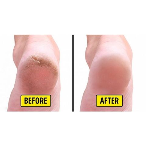 Kem Dưỡng Nứt Gót Chân và Tay Shiseido Urea 10% 100g 265876