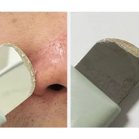 Thanh đẩy mụn ILSO - Thiết bị làm đẹp giúp loại bỏ mụn và bã nhờn hiệu quả, sản phẩm hot cuối tuần này!