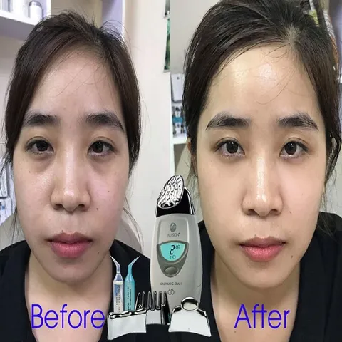 Gel Mát Xa Mặt ageLOC Galvanic Spa - Gel Chăm Sóc Da Tươi Trẻ, Ngăn Ngừa Lão Hóa, Hỗ Trợ Làm Sáng Da 2027