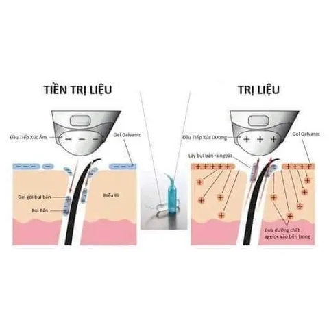 Gel Mát Xa Mặt ageLOC Galvanic Spa - Gel Chăm Sóc Da Tươi Trẻ, Ngăn Ngừa Lão Hóa, Hỗ Trợ Làm Sáng Da 2027