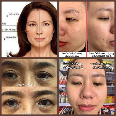 Gel Mát Xa Mặt ageLOC Galvanic Spa - Gel Chăm Sóc Da Tươi Trẻ, Ngăn Ngừa Lão Hóa, Hỗ Trợ Làm Sáng Da 2027