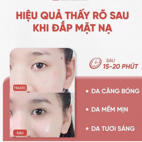 Mặt Nạ PDRN Kyunglab 23ml - Mặt Nạ Dưỡng Ẩm Căng Bóng Đặc Biệt Chăm Sóc Da Hàn Quốc, Phục Hồi Da Hư Tổn