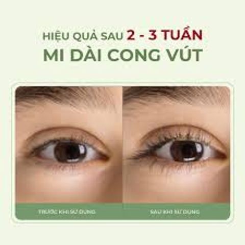 Serum Dưỡng Mi ABERA 5ml - Làm Dài Dày Mi, Cải Thiện Tình Trạng Mi Thưa, Chăm Sóc Mi Tự Nhiên, Chiết Xuất Hồng Sâm, Vitamin E