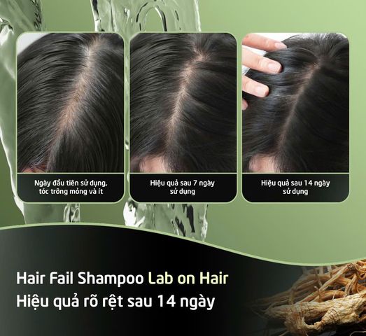 Dầu Gội Gừng Lab On Hair 300ml - Giải Pháp Chống Rụng Tóc Với Nhân Sâm & Redensyl, Tăng Cường Tóc Khỏe Mạnh