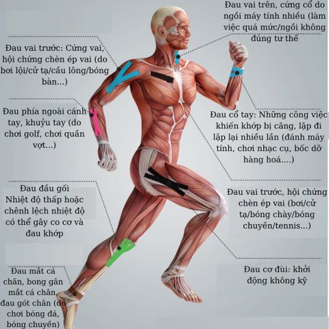 Băng keo dán cơ thể thao Kinesiology LI-NING  bảo vệ cơ, chống căng cơ, phục hồi chấn thương LQAK100