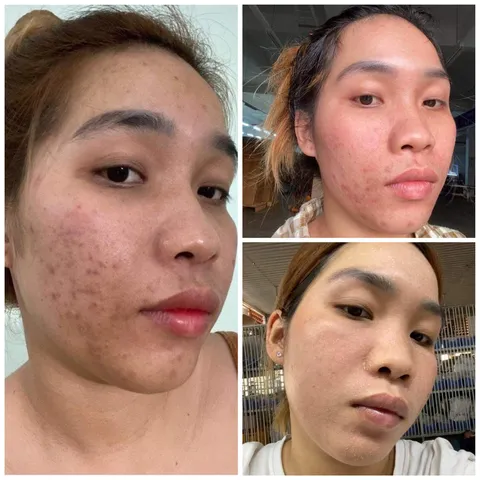 Bột sâm đông y Hạnh Sino 100% thiên nhiên tái tạo da - Giúp da khỏe đẹp từ gốc, giảm mụn thâm nám, phục hồi tự nhiên - Dung tích 100ml