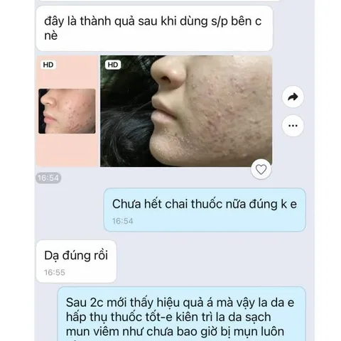 Bột sâm đông y Hạnh Sino 100% thiên nhiên tái tạo da - Giúp da khỏe đẹp từ gốc, giảm mụn thâm nám, phục hồi tự nhiên - Dung tích 100ml