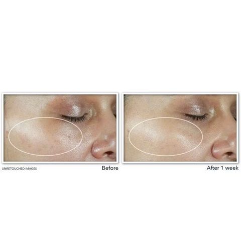 Kem Dưỡng Ẩm Vitamin C RoC Multi Correxion Revive + Glow SPF30 - Ngăn Ngừa Lão Hóa, Làm Sáng Da, Chống Nắng hiệu quả