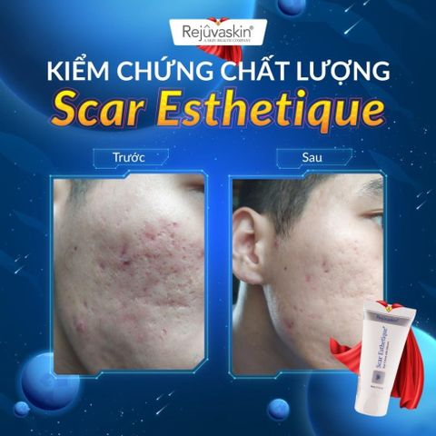 Kem làm mờ Sẹo Scar Esthetique Rejuvaskin 10ml - Chuyên dùng cho sẹo thâm, sẹo rỗ, ngăn ngừa sẹo lồi, an toàn cho mọi loại da