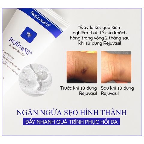 Gel Silicone Ngăn Ngừa Sẹo RejuvaSil 30ml - Làm Xẹp Sẹo Lồi, Phục hồi Da, An Toàn Cho Trẻ Em, Giảm Ngứa, Kích Ứng