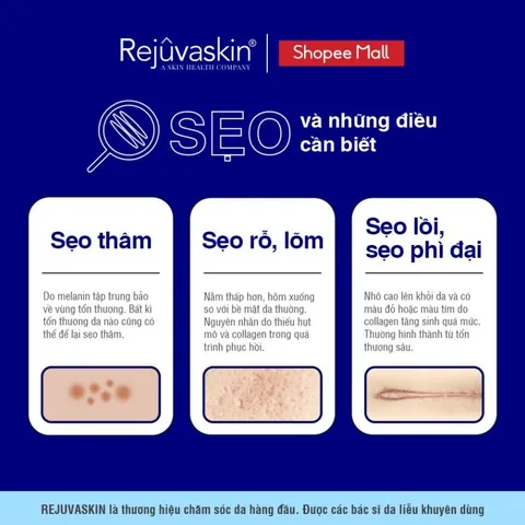 Miếng Dán Làm Xẹp Sẹo Lồi REJUVASKIN Scar FX - Giảm sẹo, Chăm sóc da, Silicone Y Tế, Phục hồi vết thương hiệu quả