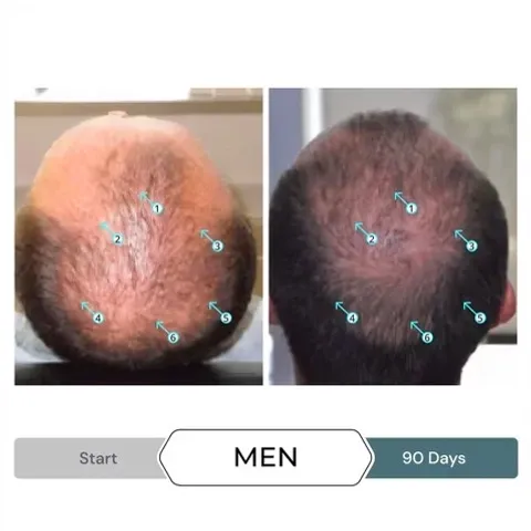 Serum Kích Thích Mọc Tóc SPECTRAL.F7 60ml - Giảm Gãy Rụng Tóc, Phục Hồi Mái Tóc Dày và Đầy Đặn cho Nam Nữ
