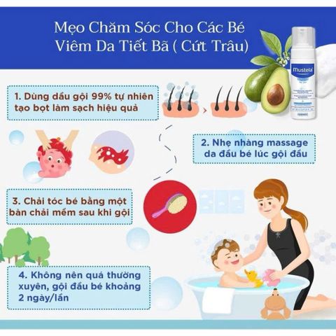 Dầu Gội Ngăn Ngừa Cứt Trâu Cho Trẻ Sơ Sinh & Em Bé Mustela 150ml 278822