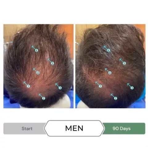 Dầu Xả Kích Thích Mọc Tóc Revita.CBD 205ml - Chống Oxy Hóa, Tăng Độ Dày và Khỏe Mạnh Tóc, An Toàn Không Sunfat