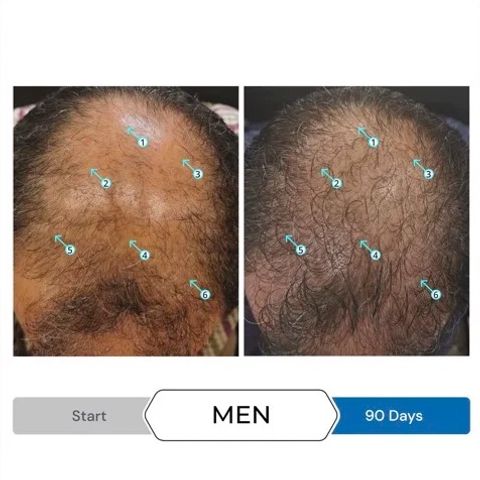 Serum Kích Thích Mọc Tóc SPECTRAL.UHP® 60ml cho Đàn Ông - Trị Gãy Rụng Tóc Hiệu Quả từ Ds Laboratories (Mỹ)