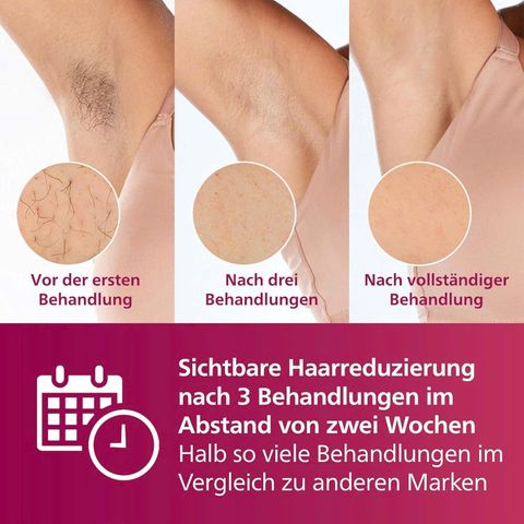 Máy Triệt Lông Philips Lumea Advanced IPL BRI923 - Công Nghệ IPL Hiện Đại, Giúp Da Mịn Màng, Không Đau, Dùng Cho Mặt, Nách, Bikini