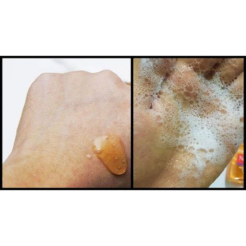 Sữa Rửa Mặt Neutrogena Oil - Free Acne Wash MicroClear - 175ml