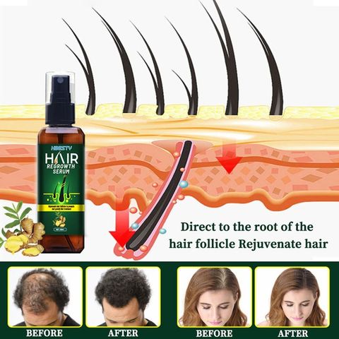 Serum dưỡng mọc tóc, giúp tóc mọc nhanh, nhiều và dày, sợi tóc đen bóng Nhật Bản - Giúp Tóc Dày Khỏe, Bóng Mượt và Ngăn Gãy Rụng - Sản Phẩm Chăm Sóc Tóc Tự Nhiên - Mã 1230