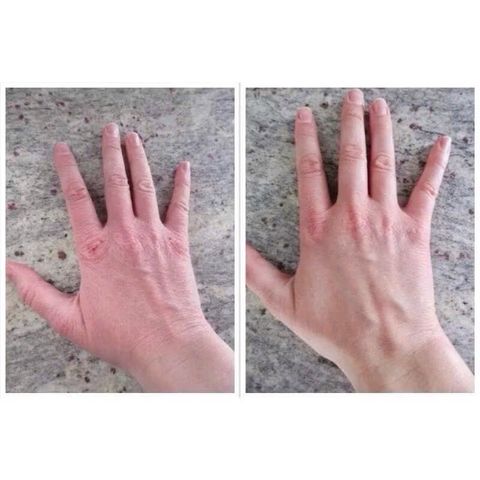 KEM DƯỠNG DA TAY KHÔ, NỨT DERMAL THERAPY HAND BALM TUÝP 50G