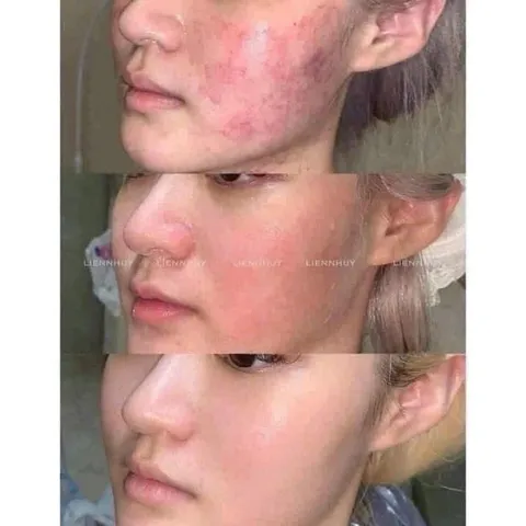 Serum B5 La Roche Posay 10ml