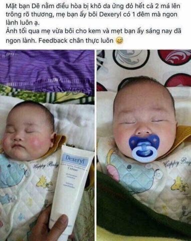 Kem nẻ thần thánh mẫu mới Glycerol Vaseline Paraffine
