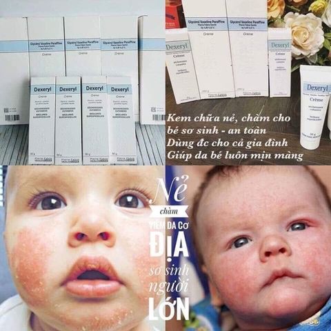 Kem nẻ thần thánh mẫu mới Glycerol Vaseline Paraffine