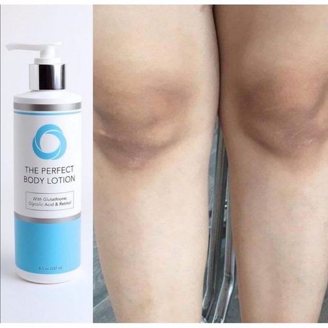 Sữa Dưỡng Thể & Sữa Tắm Trắng Da Chống Lão Hoá Perfect Body Lotion 15% Glycolic Acid - Tẩy Tế Bào Chết & Làm Sáng Da 250ml