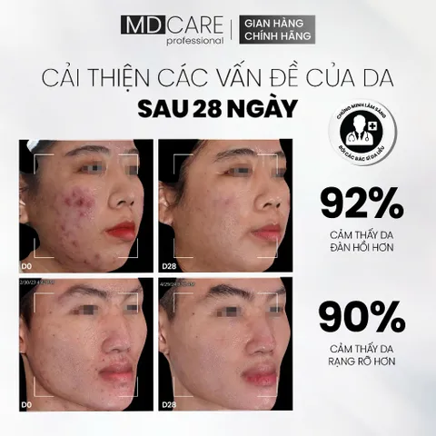 Gel NMF MD CARE Kiểm Soát Dầu 50ml - Tái Tạo Và Phục Hồi Hàng Rào Bảo Vệ Da, Cấp Ẩm Chuyên Sâu, An Toàn Cho Da Nhạy Cảm